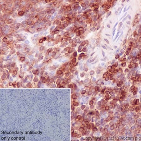 Anti-Bcl-2 antibody [EPR17509](AB182858)