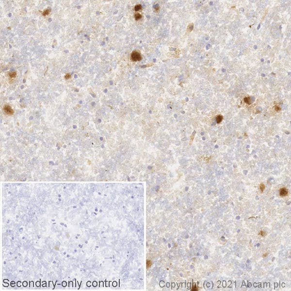 Alpha Synuclein Antibody Mjfr1 Bsa And Azide Free Ab209420 Immunohistochemistry Frozen Sections Img180019