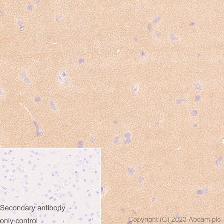 Pkm Antibody Epr10139 Ab154816  Immunohistochemistry Formalin Pfa Fixed Paraffin Embedded Sections Img417312