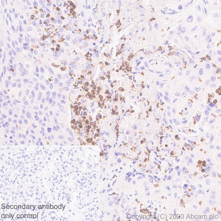 Anti-Neutrophil Elastase antibody [EPR28386-66](AB310335)