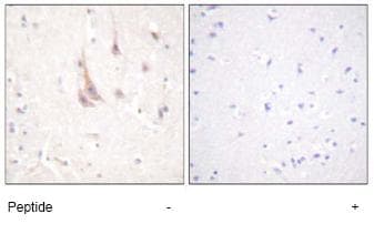 Anti-PKC zeta antibody(ab59364)