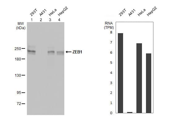 Anti-ZEB1 antibody(AB155249)