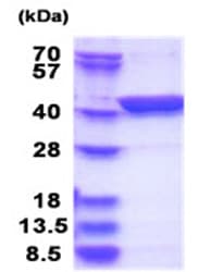 Ab181923  Sds Page Img79973