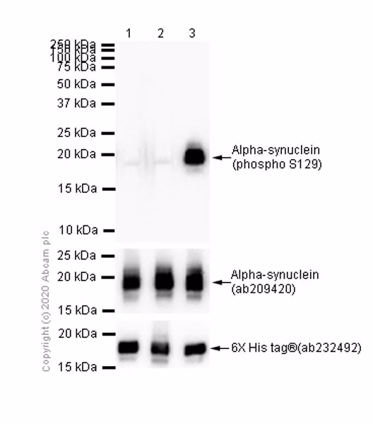 Alpha Synuclein Phospho S129 Antibody Ep1536y Ab51253 Western Blot Img176610