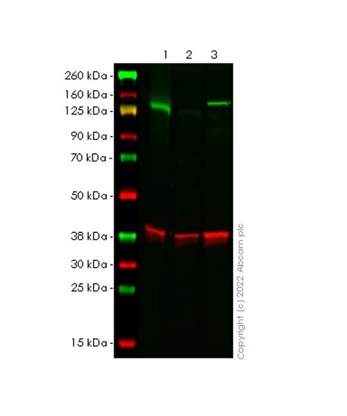 Anti-TYK2 antibody [EPR24628-106](AB303500)