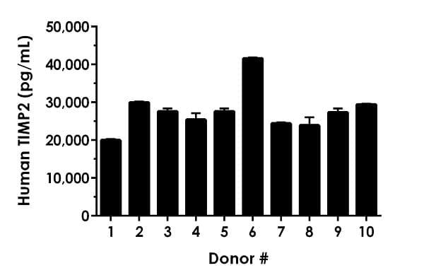 Human TIMP2 ELISA Kit(AB270213)