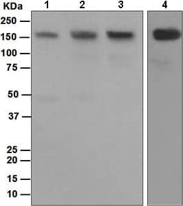 Hdac6 Antibody Epr16982 Ab133493  Western Blot Img112483