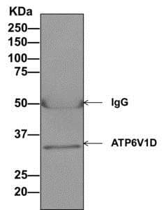 Anti-ATP6V1D antibody [EPR11326(B)](AB157458)