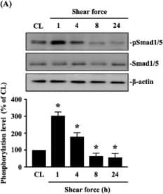 Smad1 5 9 Antibody Ab80255  Western Blot Img442956