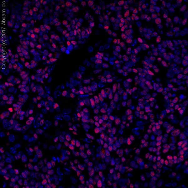 Anti-MASH1/Achaete-scute homolog 1 antibody [EPR19840](AB211327)