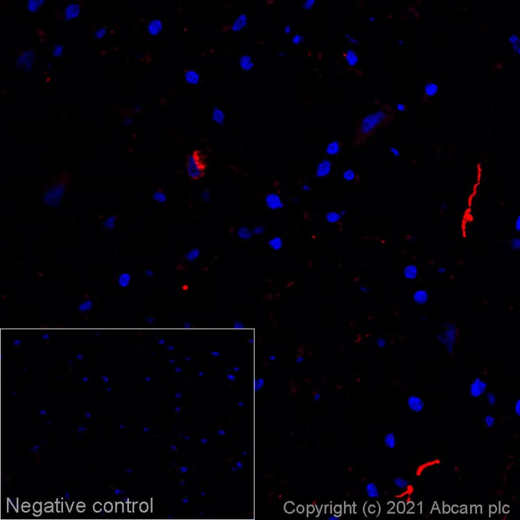 Alexa Fluor® 594 Anti-Alpha-synuclein aggregate antibody [MJFR-14-6-4-2](AB283628)