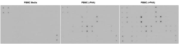 Human Inflammation Antibody Array Membrane 40 Targets Ab134003  Multiplex Protein Detection Img56719