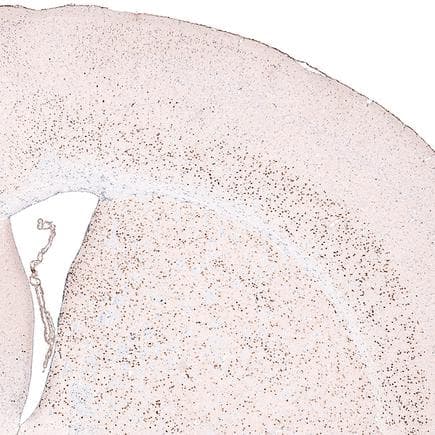 Anti-FOXP2 antibody [CL5312](AB243038)