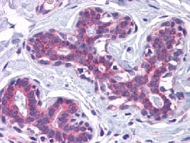 Scamp4 Antibody Ab113651  Immunohistochemistry Formalin Pfa Fixed Paraffin Embedded Sections Img64385