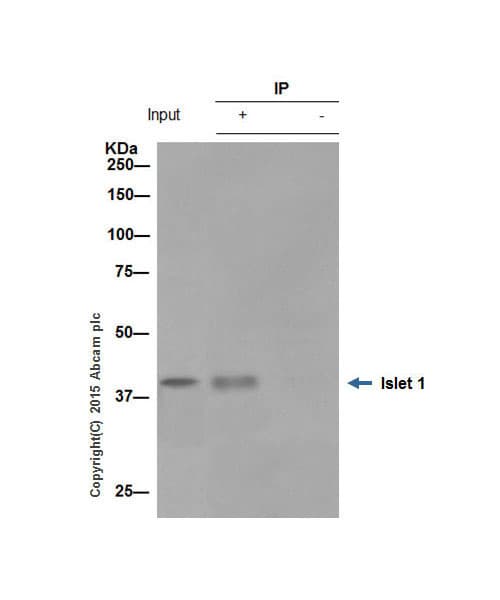 Anti-Islet 1 antibody [EP4182] - Neural Stem Cell Marker(AB109517)