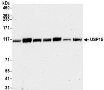 Usp15 Antibody Ab71713  Western Blot Img184016