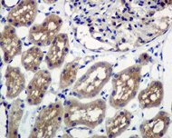 Ube2l6 Antibody Epr42672 Ab109086  Immunohistochemistry Formalin Pfa Fixed Paraffin Embedded Sections Img137814