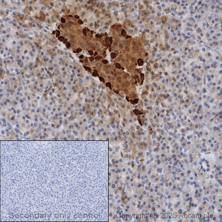 Anti-Glucagon antibody [EP3070](AB92517)