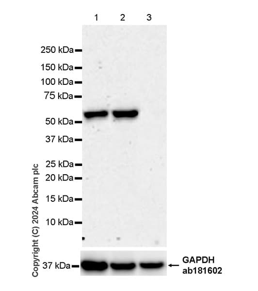 Anti-ST2 antibody [EPR28307-82](AB317557)