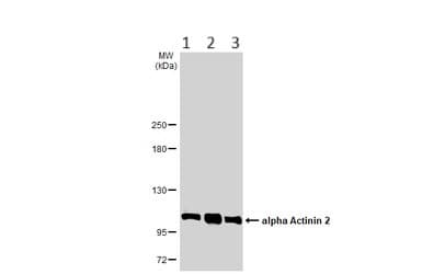 Anti-Sarcomeric Alpha Actinin antibody(AB137346)
