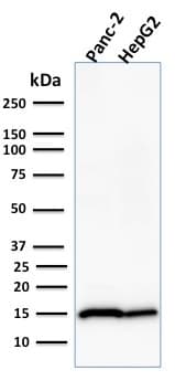 Frataxin Antibody Fxn 2124 Ab268063  Western Blot Img3762