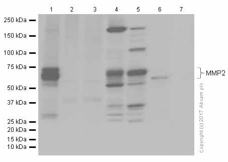 Anti-MMP2 antibody [EPR1184](AB92536)