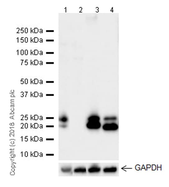 Anti-Proteasome 20S LMP2 antibody [EPR22042](AB242061)
