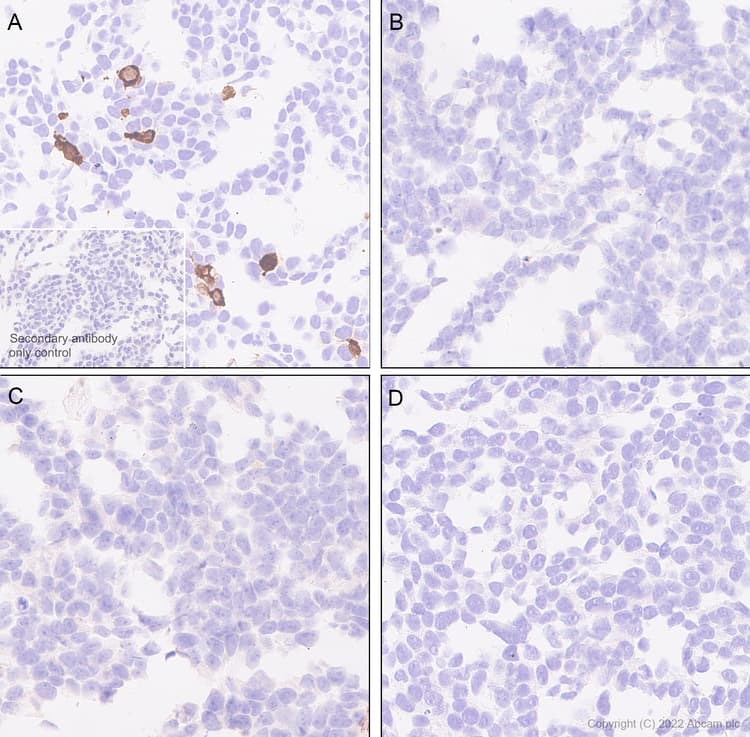 Anti-Aldolase C - C-terminal antibody [EPR26896-2] - BSA and Azide free(AB307413)