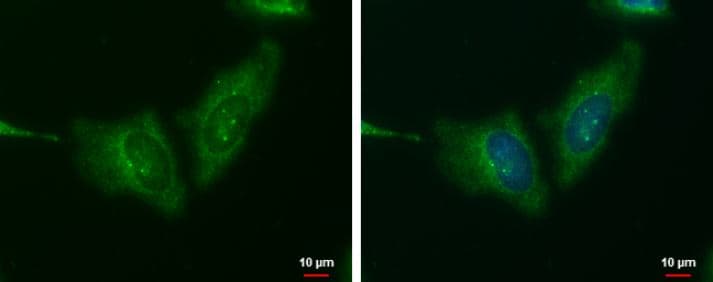 Wnt11 Antibody Ab96730  Immunocytochemistry Immunofluorescence Img93326
