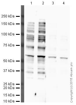 Anti-p53 antibody [PAb 240](AB26)