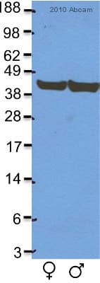 Anti-beta Actin antibody [mAbcam 8224] - Loading Control(AB8224)