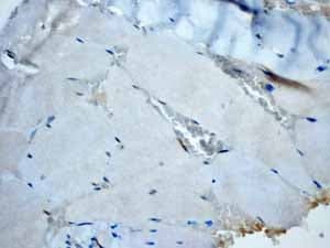 Anti-Calponin 1 antibody [EP798Y](AB46794)