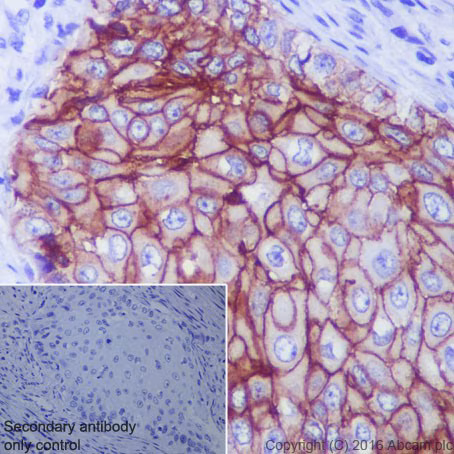 Trop2 Antibody Epr20043 Ab214488 Immunohistochemistry Formalin Pfa Fixed Paraffin Embedded Sections Img23725