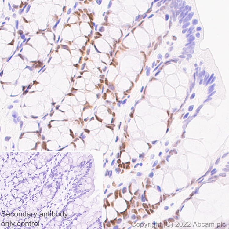 Anti-UBR7 antibody [EPR26170-67]