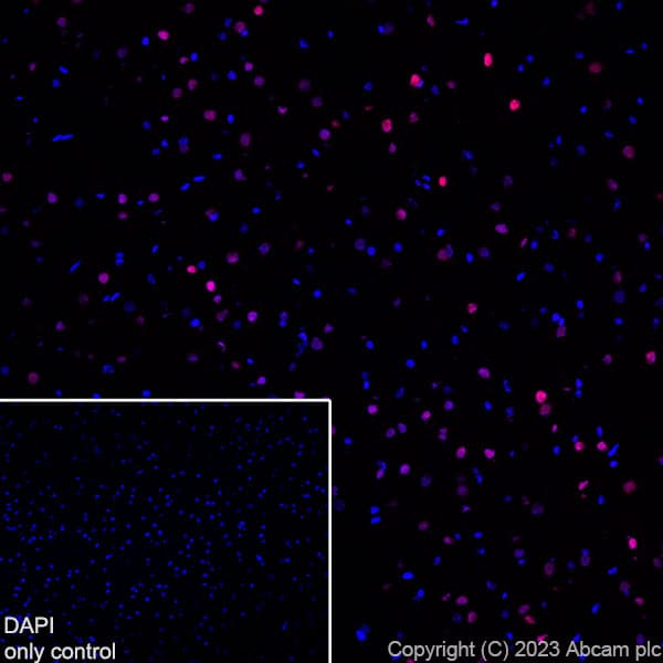 Alexa Fluor® 647 Anti-TBR1 antibody [EPR8138(2)](AB314473)