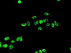 Cdc5l Antibody Epr7658 Bsa And Azide Free Ab248312  Immunocytochemistry Immunofluorescence Img122192