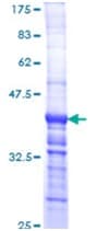 Recombinant Human Laminin 2 alpha protein(AB114155)