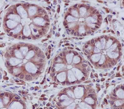 Anti-UFC1 antibody [EPR15014](AB189251)