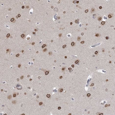 Anti-KMT2D / MLL2 antibody(AB224156)