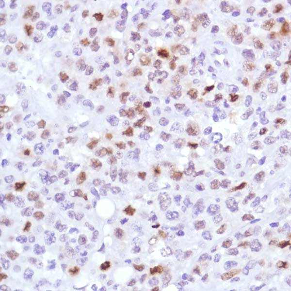 Anti-Cyclin D3/CCND3 antibody [SP207] - BSA and Azide free(AB245734)