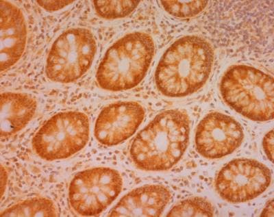 Anti-SDHB antibody [21A11AE7](AB14714)