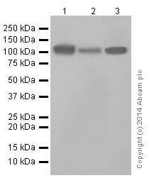 Anti-LAMP2A antibody [EPR4207(2)] - Lysosome Marker(AB125068)