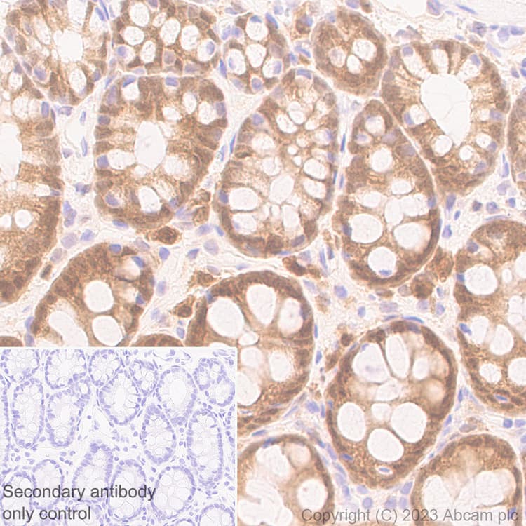 Anti-TMS1/ASC antibody [RM1049](AB309497)
