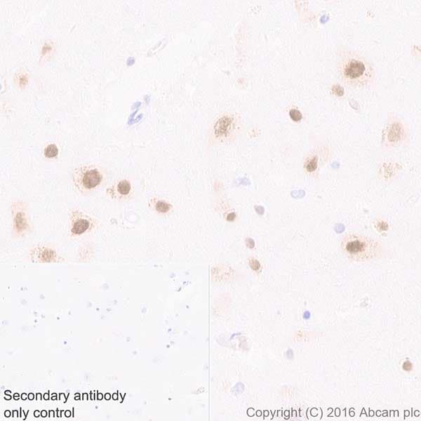Anti-HuD + HuC antibody [EPR19098](AB184267)