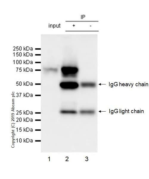 Anti-EWSR1/EWS antibody [21B1](ab252829)