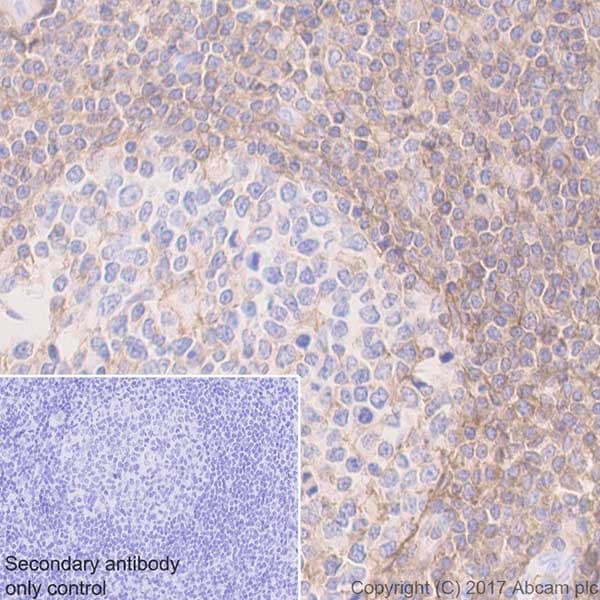 Anti-CD44 antibody [EPR18668](AB189524)