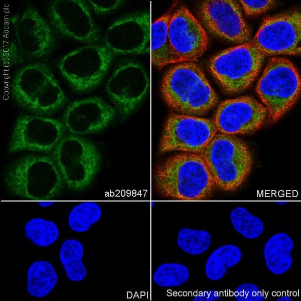 Anti-Hexokinase II antibody [EPR20839](AB209847)