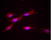 Acaa1 Beta Ketothiolase Antibody 2h6be7 Ab110289  Immunocytochemistry Img114342