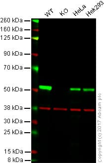 Anti-beta III Tubulin antibody [EP1569Y] - Neuronal Marker(AB52623)