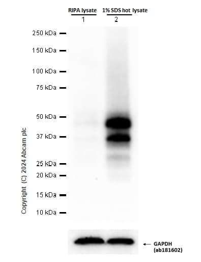 Anti-Sp7 / Osterix antibody [EPR21034] - BSA and Azide free(ab227820)
